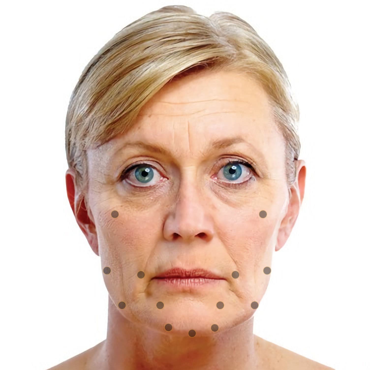 Facial treatment points discussed for Skin Bio-Armouring